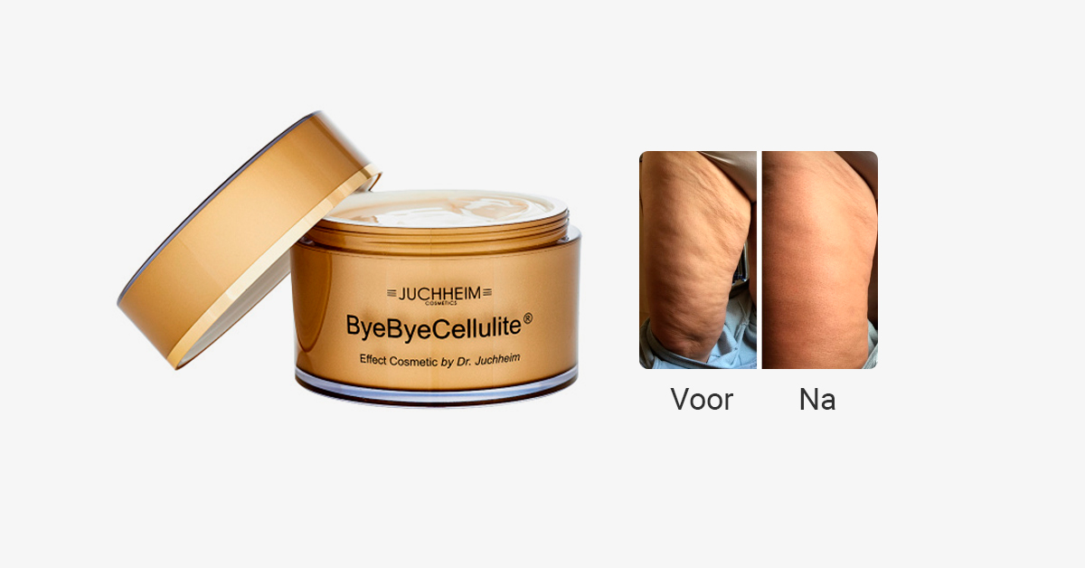 Featured image for “Gladde benen met ByeBye Cellulite by Dr. Juchheim”